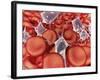 Conceptual Image of Red Blood Cells with Platelets-null-Framed Art Print