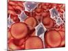 Conceptual Image of Red Blood Cells with Platelets-null-Mounted Art Print