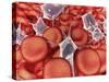 Conceptual Image of Red Blood Cells with Platelets-null-Stretched Canvas