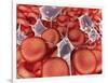 Conceptual Image of Red Blood Cells with Platelets-null-Framed Art Print