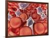 Conceptual Image of Red Blood Cells with Platelets-null-Framed Art Print