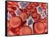 Conceptual Image of Red Blood Cells with Platelets-null-Framed Stretched Canvas