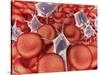 Conceptual Image of Red Blood Cells with Platelets-null-Stretched Canvas