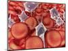 Conceptual Image of Red Blood Cells with Platelets-null-Mounted Art Print