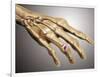 Conceptual Image of Rheumatoid Arthritis in the Human Hand-null-Framed Art Print