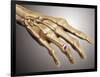 Conceptual Image of Rheumatoid Arthritis in the Human Hand-null-Framed Art Print