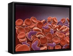 Conceptual Image of Sickle Cell Anemia with Red Blood Cells-null-Framed Stretched Canvas