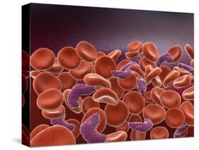 Conceptual Image of Sickle Cell Anemia with Red Blood Cells-null-Stretched Canvas