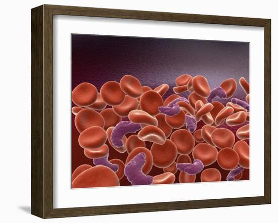 Conceptual Image of Sickle Cell Anemia with Red Blood Cells-null-Framed Art Print