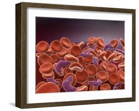 Conceptual Image of Sickle Cell Anemia with Red Blood Cells-null-Framed Art Print