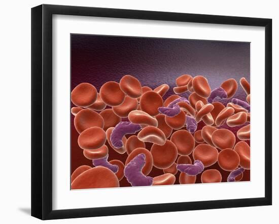 Conceptual Image of Sickle Cell Anemia with Red Blood Cells-null-Framed Art Print