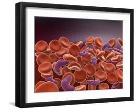 Conceptual Image of Sickle Cell Anemia with Red Blood Cells-null-Framed Art Print