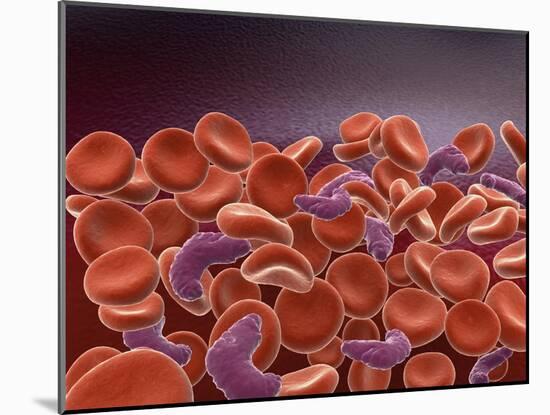 Conceptual Image of Sickle Cell Anemia with Red Blood Cells-null-Mounted Art Print