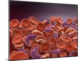 Conceptual Image of Sickle Cell Anemia with Red Blood Cells-null-Mounted Art Print