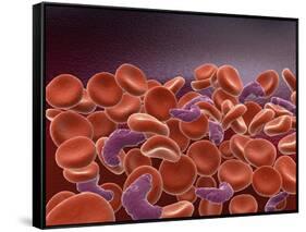 Conceptual Image of Sickle Cell Anemia with Red Blood Cells-null-Framed Stretched Canvas