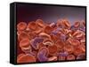 Conceptual Image of Sickle Cell Anemia with Red Blood Cells-null-Framed Stretched Canvas