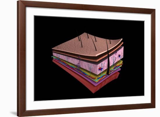Conceptual Image of the Layers of Human Skin-null-Framed Art Print