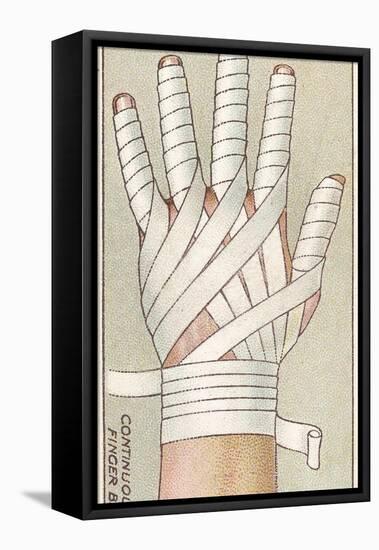 Continuous Finger Bandage, No.48 from the 'First Aid' Series of 'Wills's Cigarettes' Cards, 1913-English School-Framed Stretched Canvas