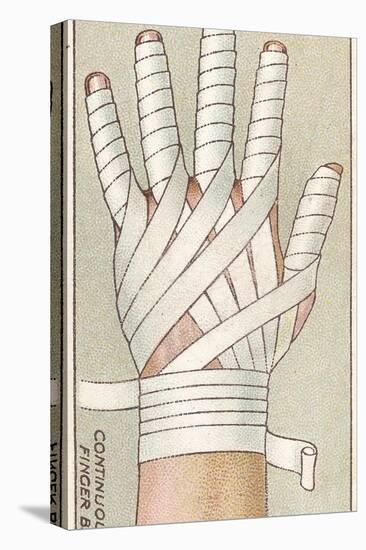 Continuous Finger Bandage, No.48 from the 'First Aid' Series of 'Wills's Cigarettes' Cards, 1913-English School-Stretched Canvas