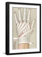 Continuous Finger Bandage, No.48 from the 'First Aid' Series of 'Wills's Cigarettes' Cards, 1913-English School-Framed Giclee Print