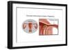 Cornual/Interstitial Pregnancy-Gwen Shockey-Framed Premium Giclee Print