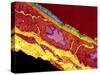 Coronary Artery, TEM-Thomas Deerinck-Stretched Canvas