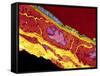 Coronary Artery, TEM-Thomas Deerinck-Framed Stretched Canvas