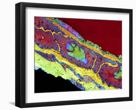 Coronary Artery, TEM-Thomas Deerinck-Framed Photographic Print