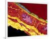 Coronary Artery, TEM-Thomas Deerinck-Framed Photographic Print