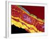 Coronary Artery, TEM-Thomas Deerinck-Framed Photographic Print