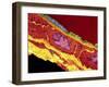 Coronary Artery, TEM-Thomas Deerinck-Framed Photographic Print