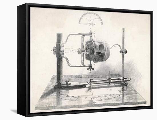 Cranionmeter Holds a Skull in Place-null-Framed Stretched Canvas