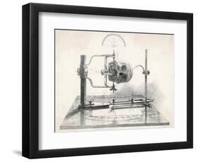 Cranionmeter Holds a Skull in Place-null-Framed Art Print