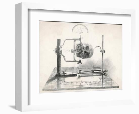 Cranionmeter Holds a Skull in Place-null-Framed Art Print