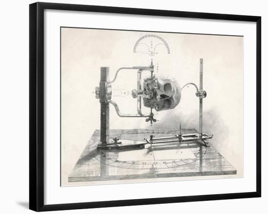 Cranionmeter Holds a Skull in Place-null-Framed Art Print