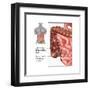 Crohn's Disease, IBD, Illustration-Gwen Shockey-Framed Art Print