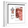 Crohn's Disease, IBD, Illustration-Gwen Shockey-Framed Art Print