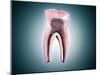 Cross-Section of a Human Tooth-null-Mounted Art Print