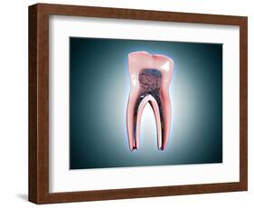 Cross-Section of a Human Tooth-null-Framed Art Print