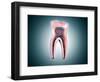 Cross-Section of a Human Tooth-null-Framed Art Print