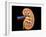 Cross Section of Human Kidney on Black Background-null-Framed Art Print