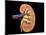 Cross Section of Human Kidney on Black Background-null-Mounted Art Print