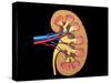 Cross Section of Human Kidney on Black Background-null-Stretched Canvas