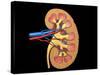 Cross Section of Human Kidney on Black Background-null-Stretched Canvas