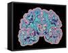 CT Scan of Brain-PASIEKA-Framed Stretched Canvas