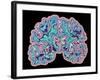 CT Scan of Brain-PASIEKA-Framed Photographic Print