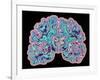 CT Scan of Brain-PASIEKA-Framed Photographic Print