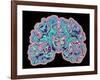 CT Scan of Brain-PASIEKA-Framed Photographic Print