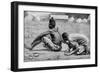 Cupping, Wet and Dry, as a Therapeutic Measure, Africa, 1922-FW Taylor-Framed Giclee Print