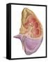 Cutaway View of the Human Kidney and Adrenal Gland-null-Framed Stretched Canvas